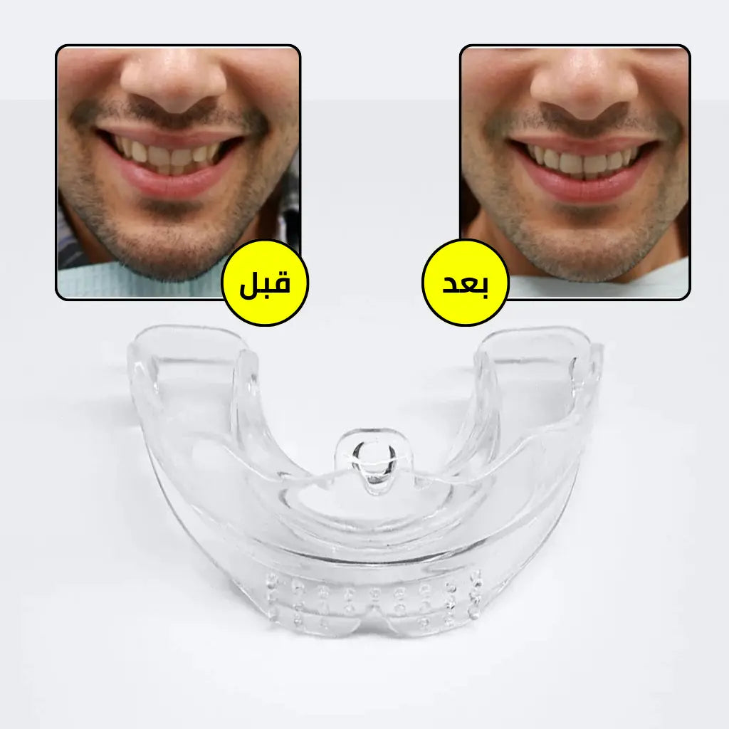 مصحّح الأسنان الذكي… الحلّ التدريجي للحصول على ابتسامة متناسقة بدون تكلفة